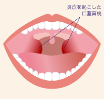 いいだ耳鼻咽喉科